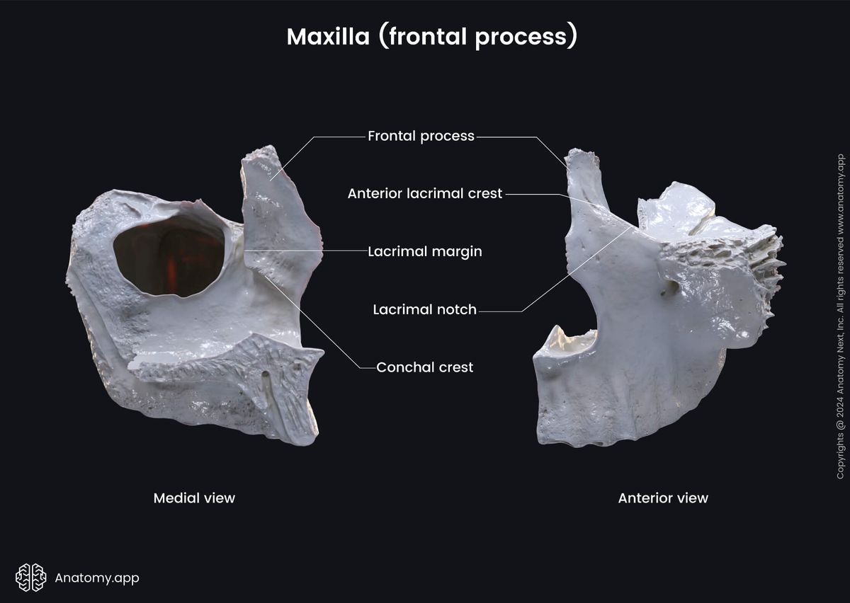 Head and neck, Skull, Viscerocranium, Facial skeleton, Maxilla, Upper jaw, Landmarks of maxilla, Processes of maxilla, Frontal process, Landmarks of frontal process, Anterior view, Medial view
