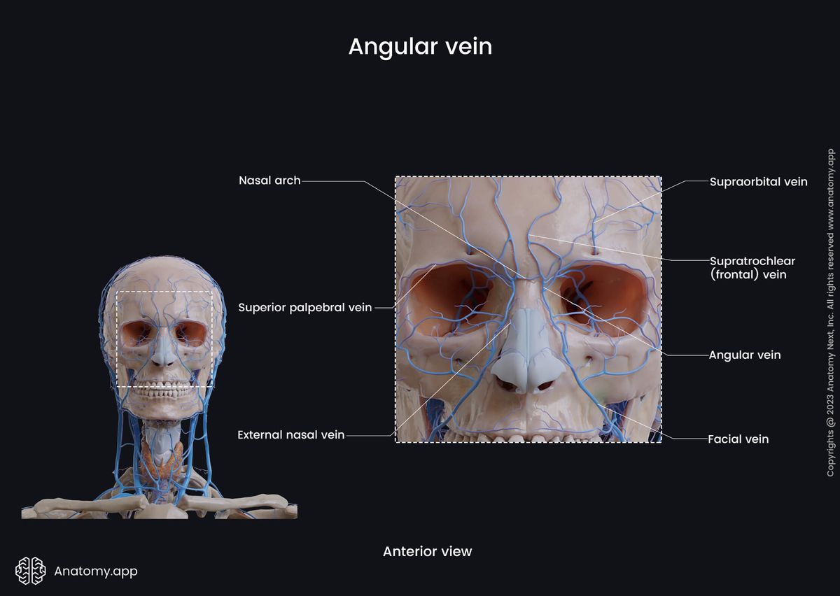 Head and neck veins, Extracranial veins, Angular vein, Supratrochlear vein, Supraorbital vein, Facial vein, Tributaries zoomed in, Anterior view 