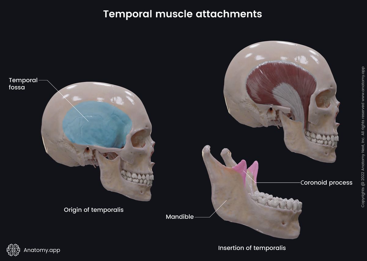 Temporalis, Temporal muscle, Masticatory muscles, Muscles of mastication, Head muscles, Origin, Insertion, Skull, Temporal bone, Mandible