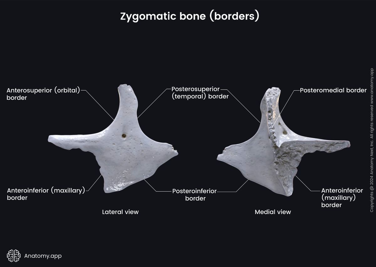 Head and neck, Skull, Viscerocranium, Facial skeleton, Zygomatic bone, Landmarks of zygomatic bone, Borders of zygomatic bone, Medial view, Lateral view