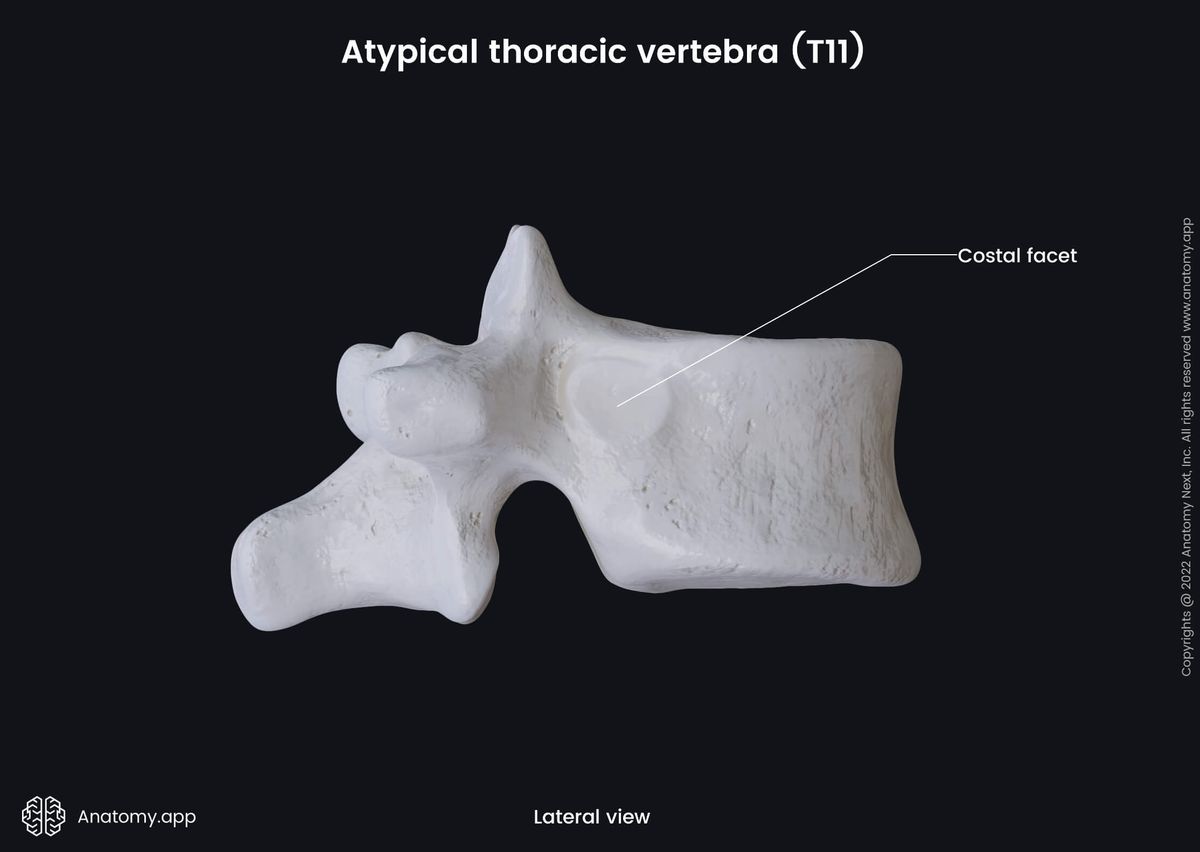 Spine, Thoracic vertebra, Atypical thoracic vertebra, Eleventh thoracic vertebra, T11, Landmarks, Costal facets, Lateral view