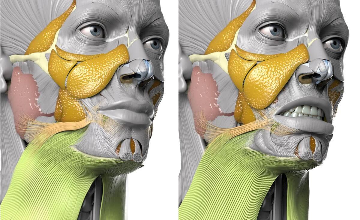Platysma, Action of platysma, Function of platysma, Superficial neck muscles, Neck muscles, Face and neck muscles, Platysma colored green, Two images (resting, activated), Relaxed platysma, Activated platysma, Facial expression