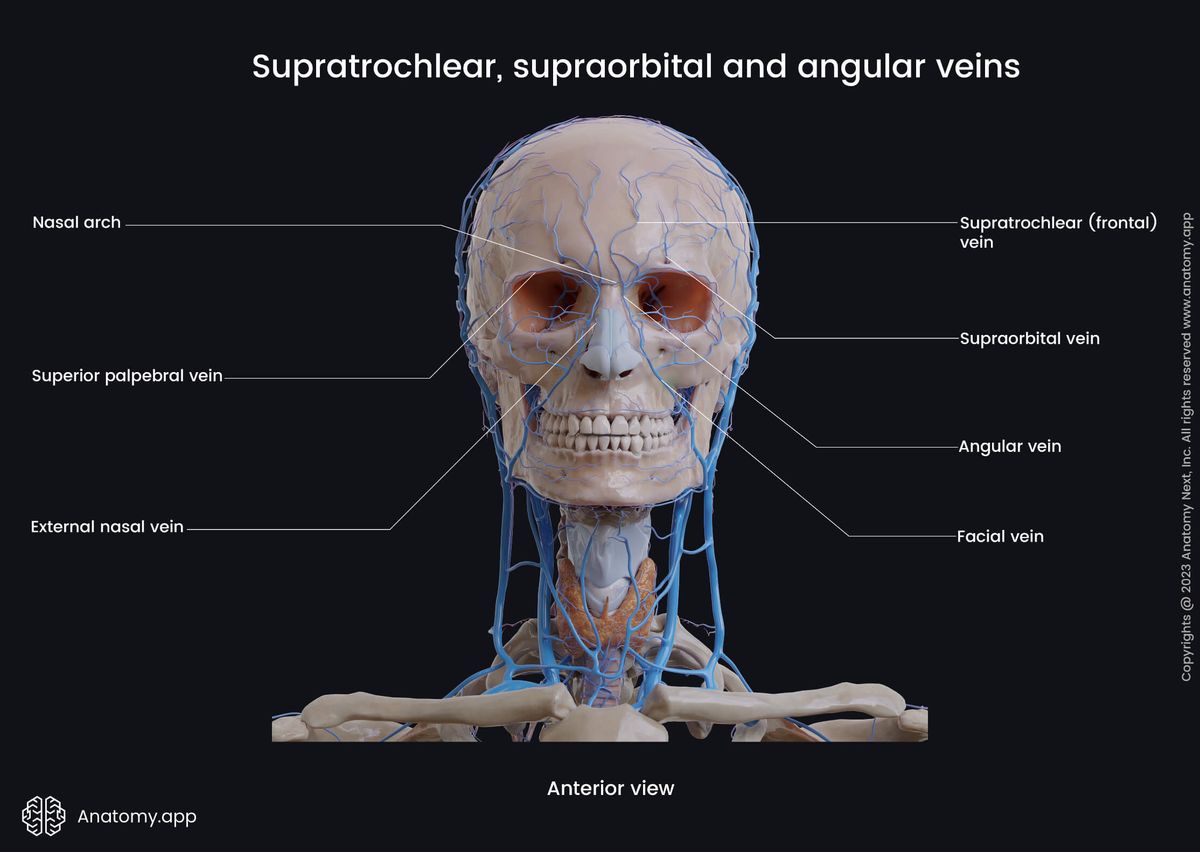 Head and neck veins, Extracranial veins, Angular vein, Supratrochlear vein, Supraorbital vein, Facial vein, Tributaries, Anterior view 