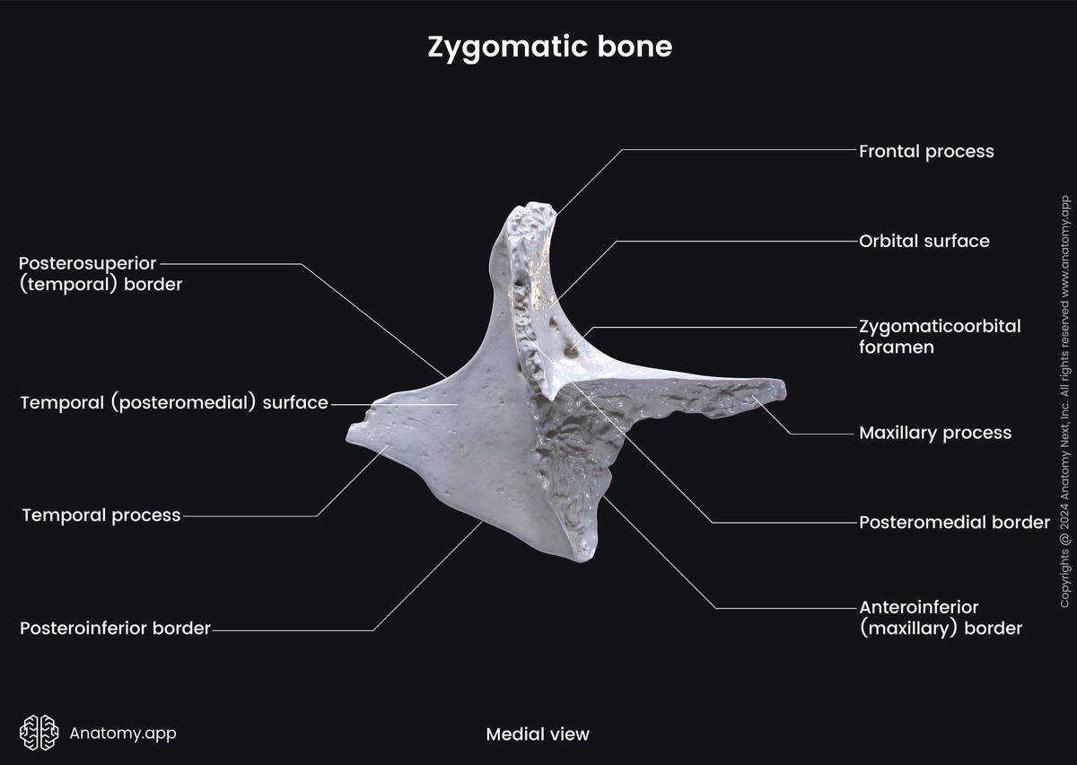 Head and neck, Skull, Viscerocranium, Facial skeleton, Zygomatic bone, Landmarks of zygomatic bone, Medial view