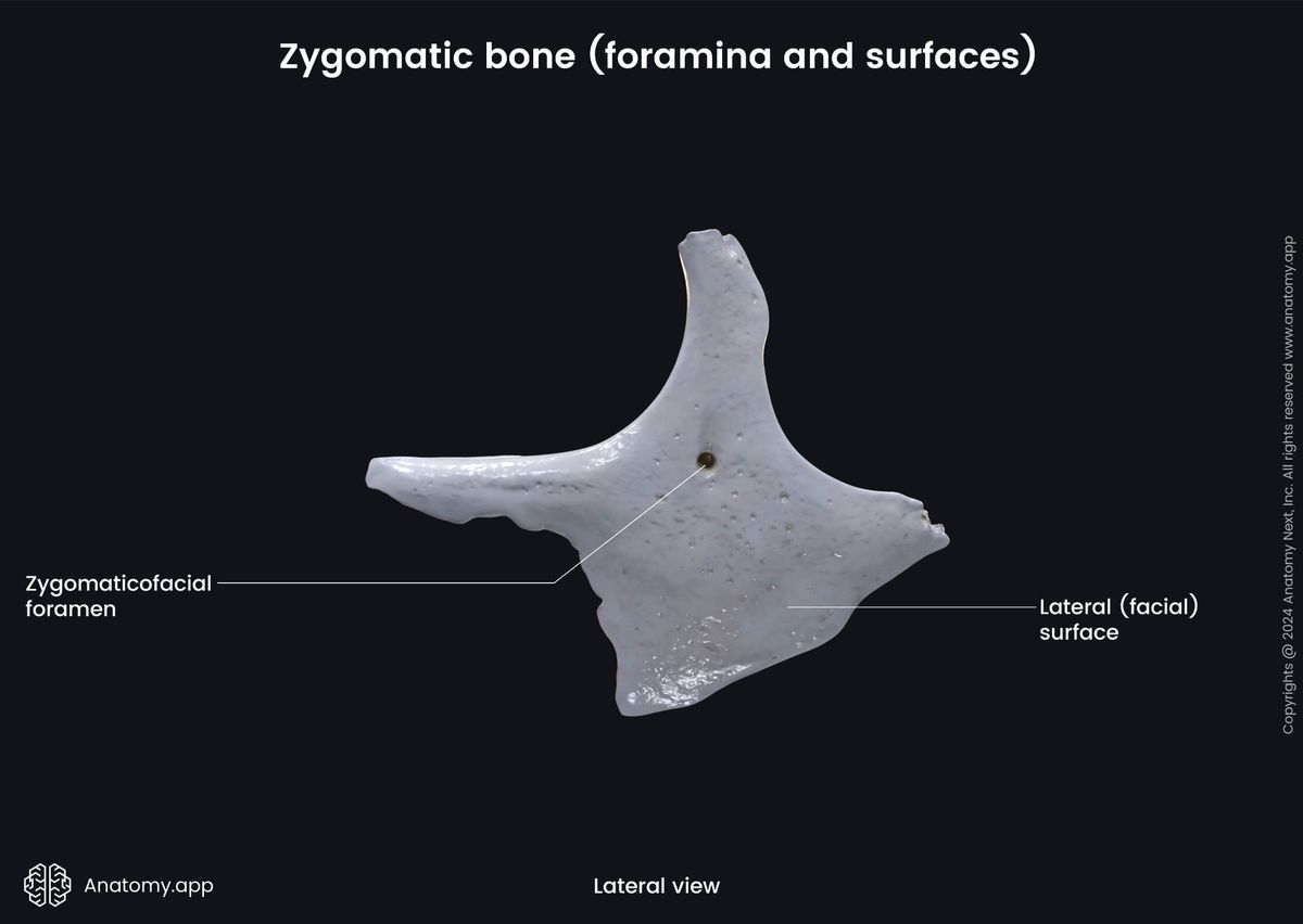 Head and neck, Skull, Viscerocranium, Facial skeleton, Zygomatic bone, Lateral surface, Landmarks of zygomatic bone, Medial view