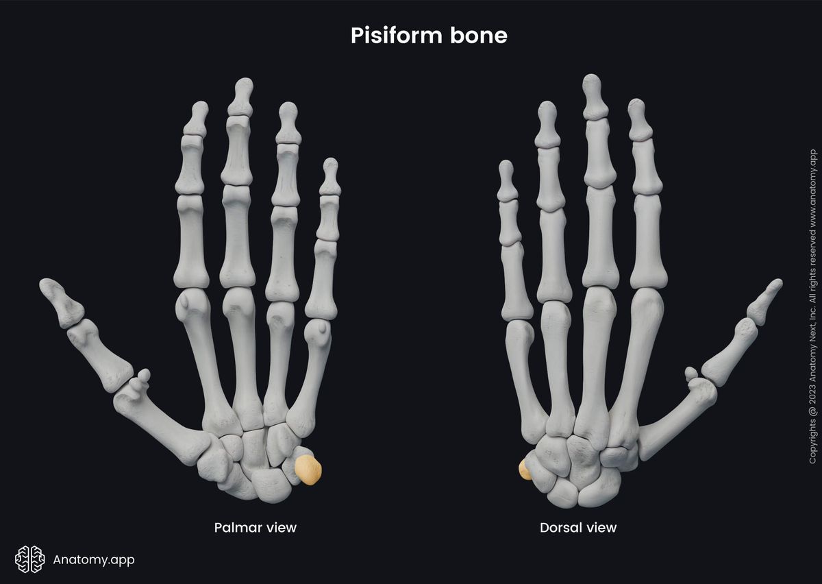Upper limb, Upper extremity, Skeletal system, Hand bones, Carpals, Carpal bones, Pisiform, Human hand, Human skeleton, Bones of hand, Palmar view, Dorsal view