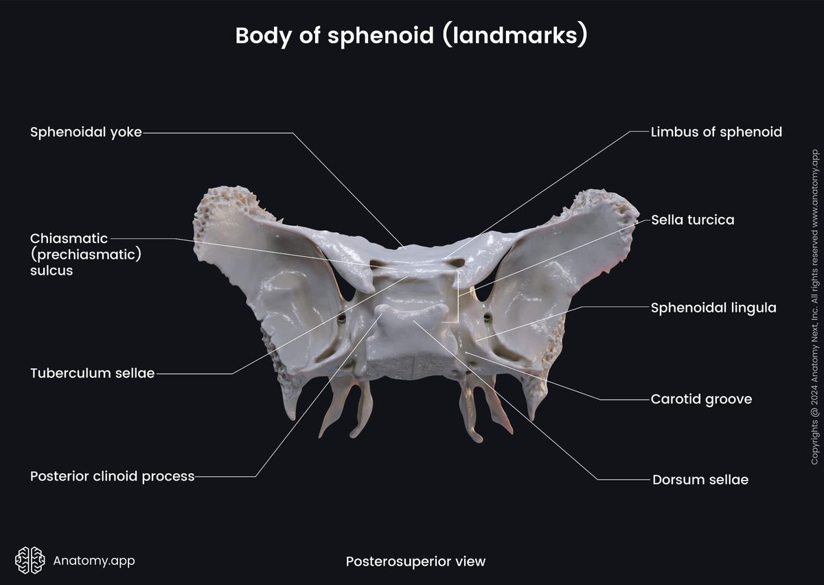 Head and neck, Skeletal system, Skull, Bones of skull, Neurocranium, Sphenoid, Parts of sphenoid, Body, landmarks, Posterosuperior view