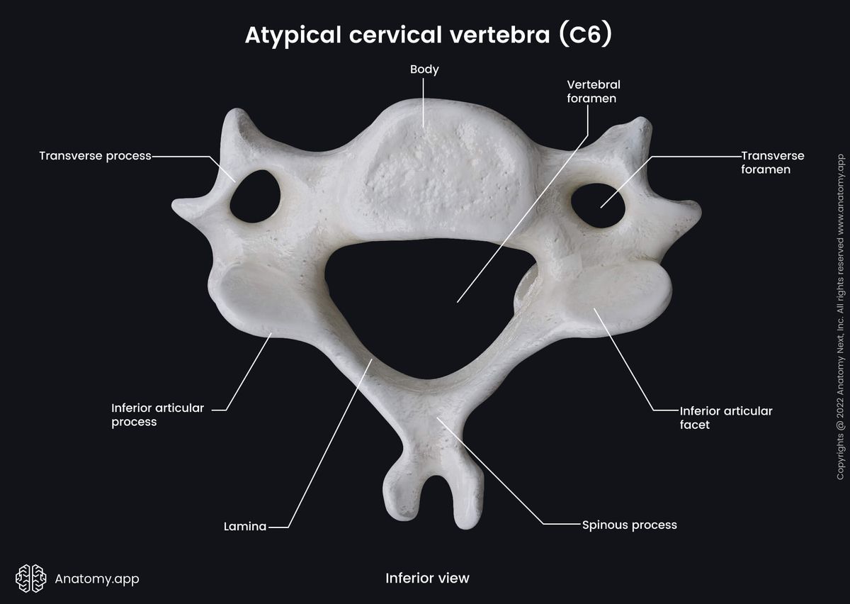 Spine, Vertebral column, Cervical vertebrae, Atypical cervical vertebrae, Sixth cervical vertebra, C6, Carotid tubercle, Landmarks, Inferior view
