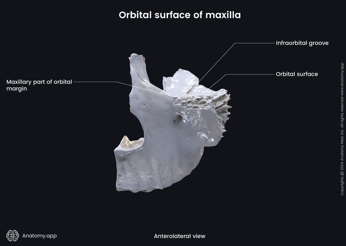 Head and neck, Skull, Viscerocranium, Facial skeleton, Maxilla, Upper jaw, Landmarks of maxilla, Body of maxilla, Orbital surface, Anterolateral view