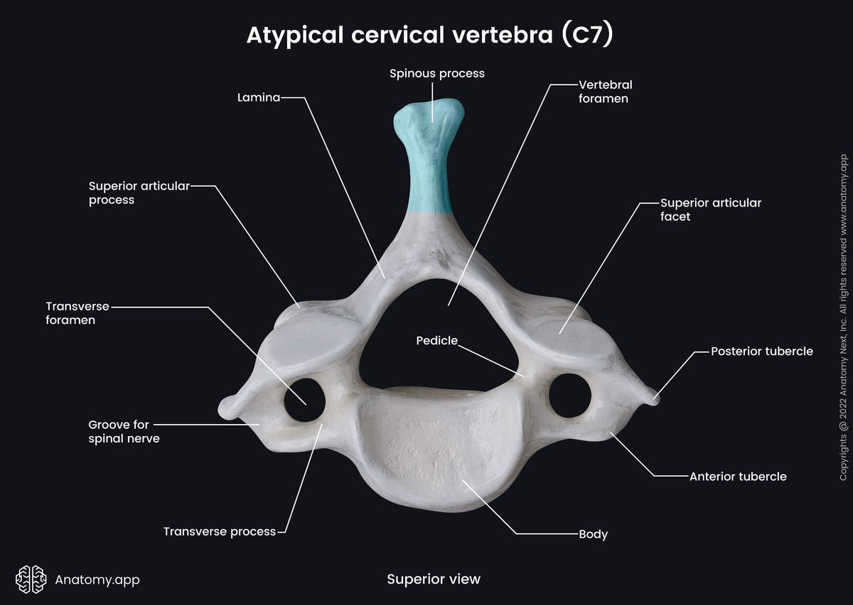 Spine, Vertebral column, Cervical vertebrae, Atypical cervical vertebrae, Seventh cervical vertebra, C7, Vertebra prominens, Landmarks, Superior view