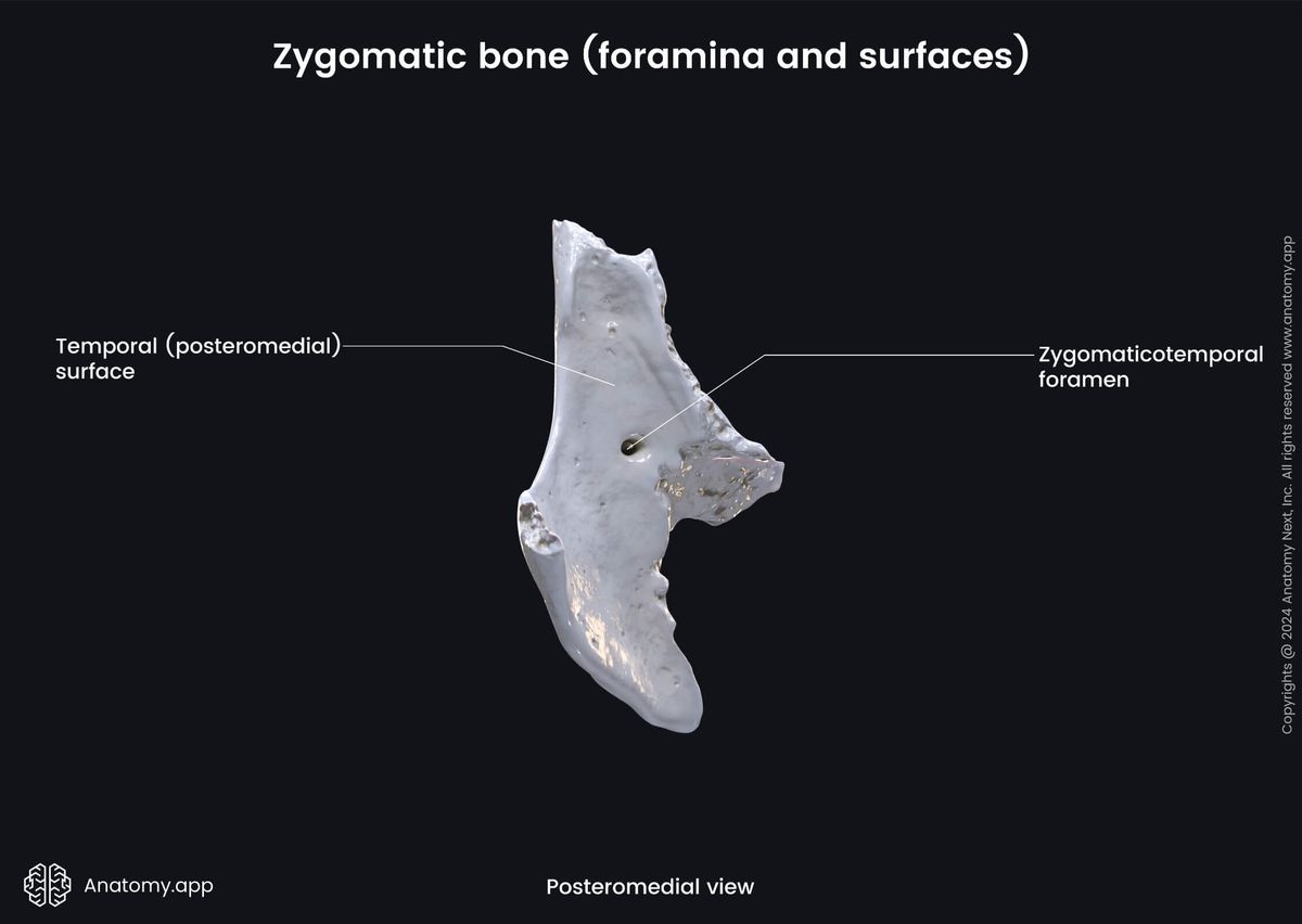 Head and neck, Skull, Viscerocranium, Facial skeleton, Zygomatic bone, Temporal surface, Landmarks of zygomatic bone, Medial view