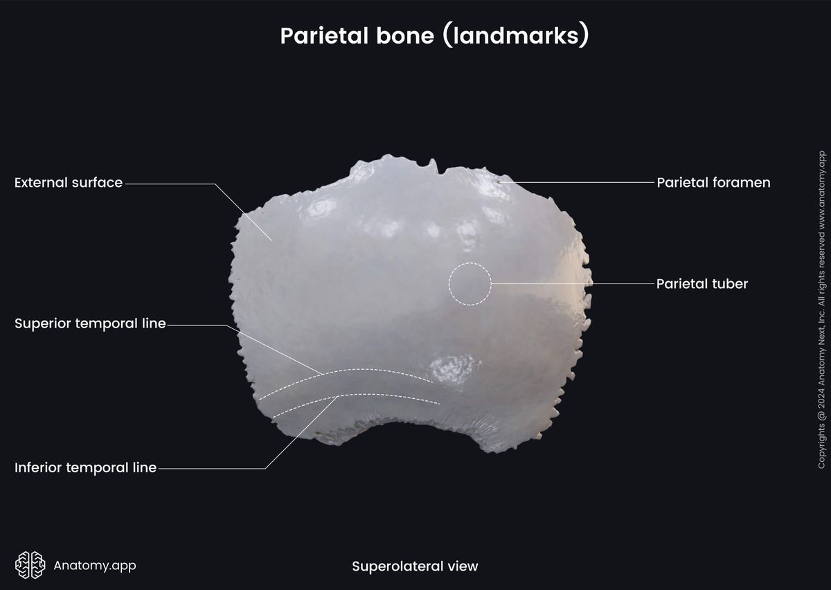 Head and neck, Skull, Cranium, Cranial bones, Neurocranium, Parietal bone, Landmarks, External surface, Superolateral view