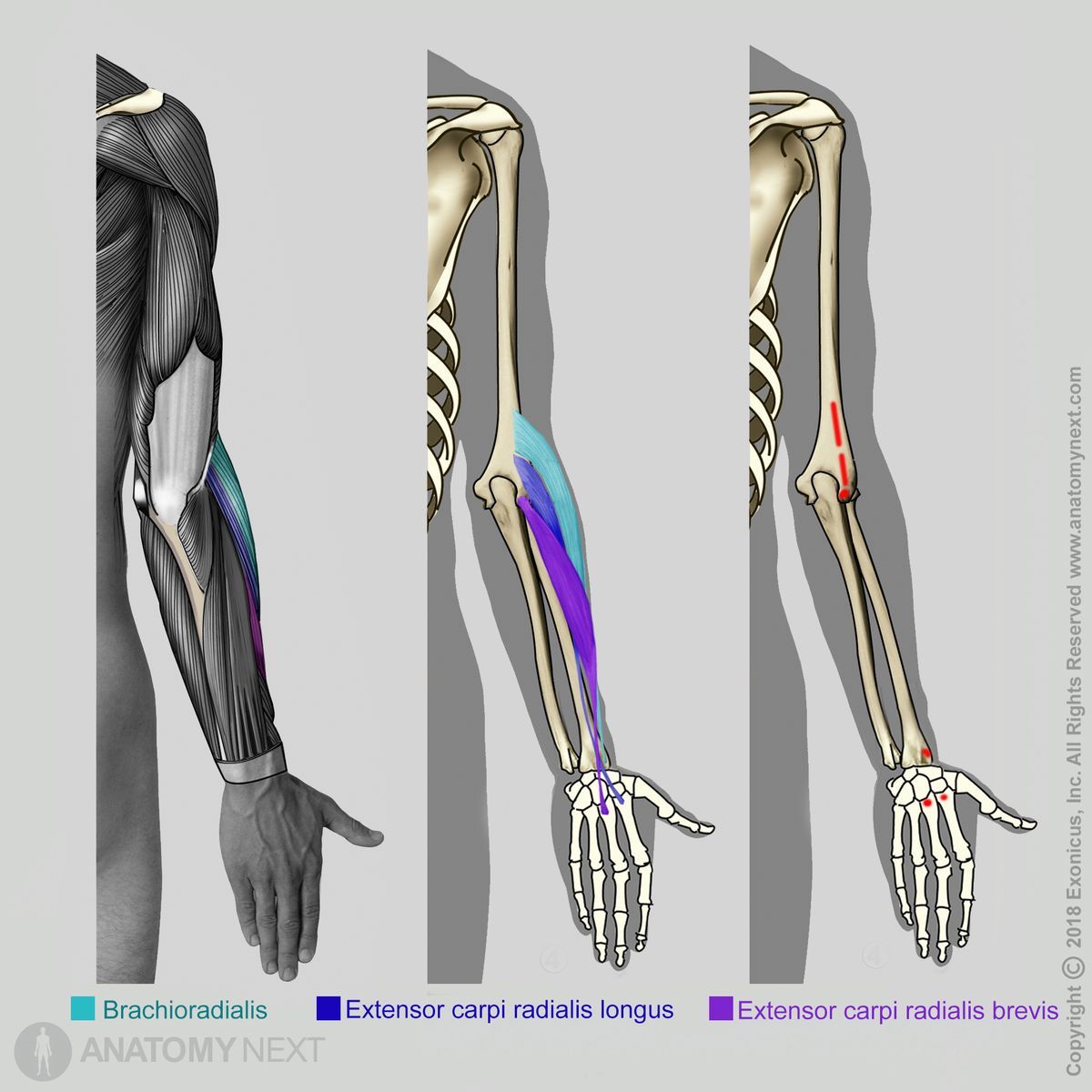 Brachioradialis, Extensor carpi radialis longus, Extensor carpi radialis brevis, Origin of brachioradialis, Origin of extensor carpi radialis longus, Origin of extensor carpi radialis brevis, Forearm muscles, Muscles of the forearm, Lateral compartment of forearm muscles, Lateral compartment muscles, Muscles of the upper limb, Arm muscles, Human muscles