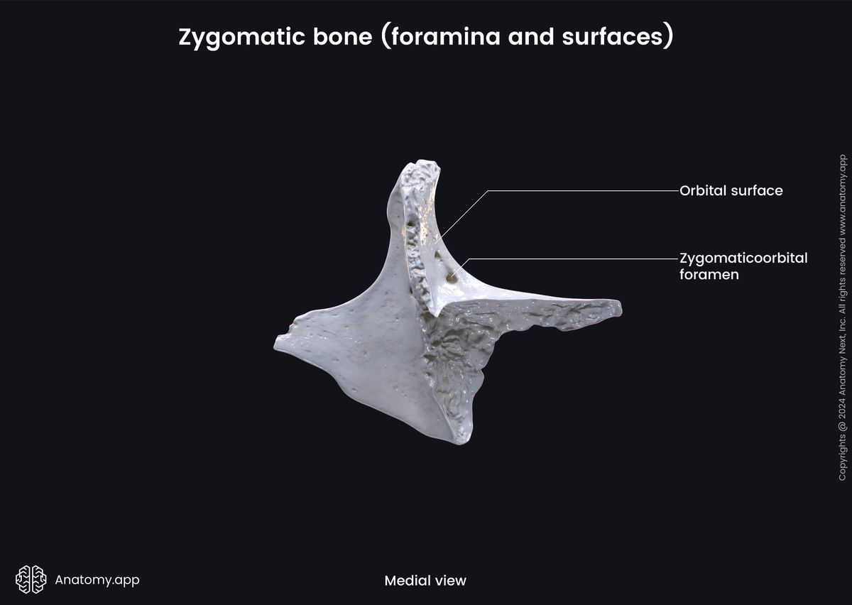 Head and neck, Skull, Viscerocranium, Facial skeleton, Zygomatic bone, Orbital surface, Landmarks of zygomatic bone, Medial view