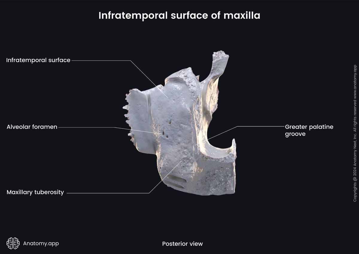 Head and neck, Skull, Viscerocranium, Facial skeleton, Maxilla, Upper jaw, Landmarks of maxilla, Body of maxilla, Infratemporal surface, Posterior view