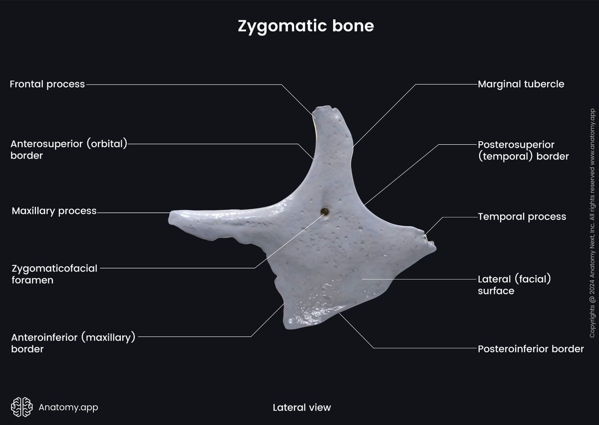 Head and neck, Skull, Viscerocranium, Facial skeleton, Zygomatic bone, Landmarks of zygomatic bone, Lateral view