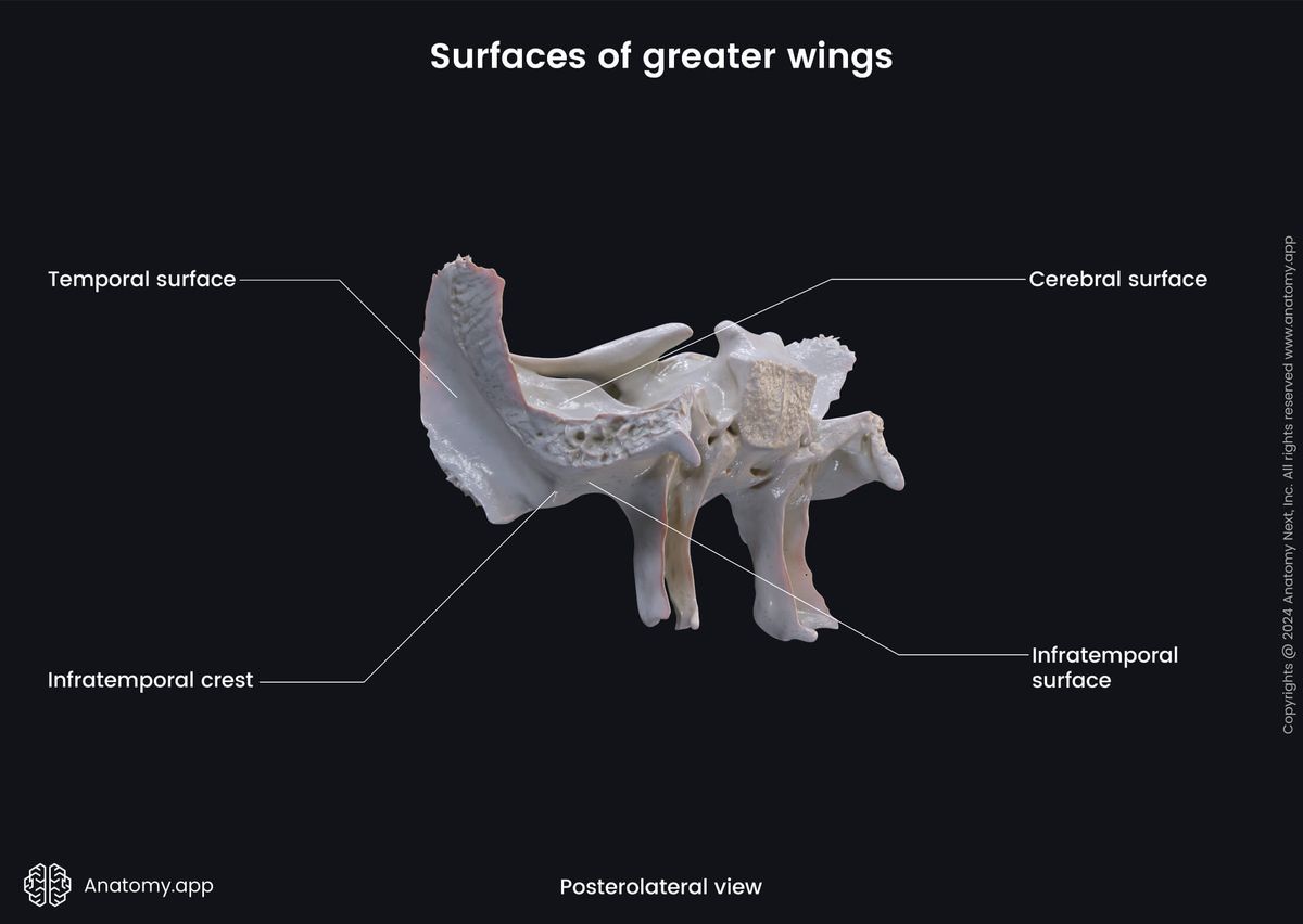 Head and neck, Skeletal system, Skull, Bones of skull, Neurocranium, Sphenoid, Parts of sphenoid, Greater wings, Surfaces, Posterolateral view
