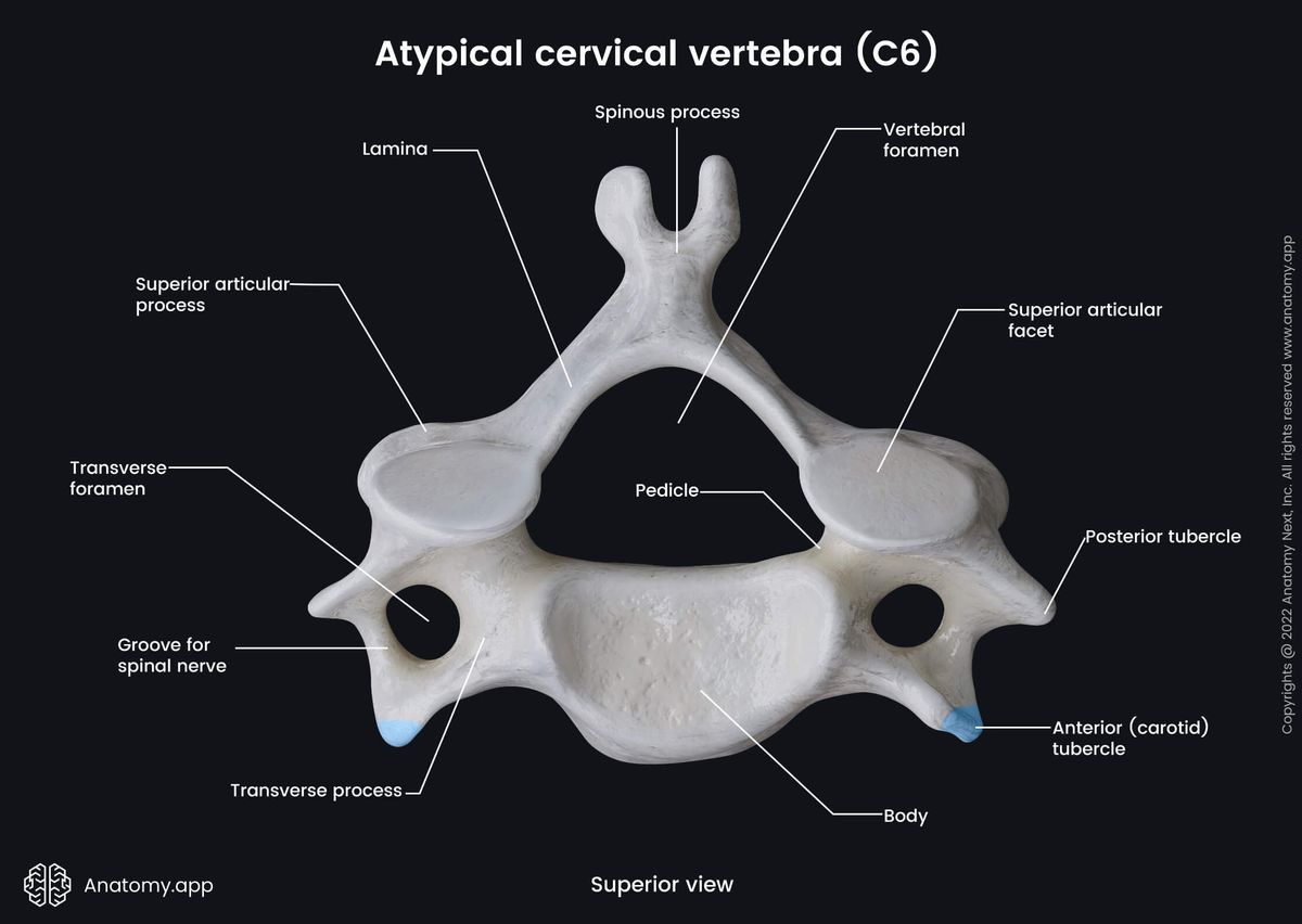 Spine, Vertebral column, Cervical vertebrae, Atypical cervical vertebrae, Sixth cervical vertebra, C6, Carotid tubercle, Landmarks, Superior view
